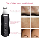 Ultrasonic SkinSkin Peeling Extractor Facial Deep Cleaning Skin Rejuvenation Face Mist