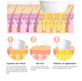 Digital IPL Laser Hair Removal