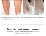 Digital IPL Laser Hair Removal